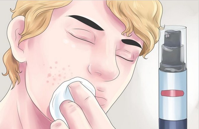 TOP 8 Cách trị mụn dưới da tại nhà, dễ làm hiệu quả sau 48h