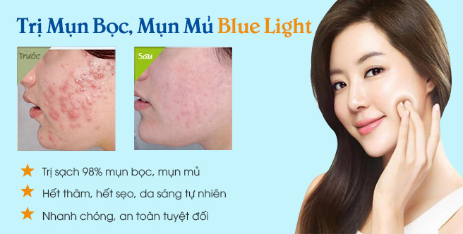 Cách trị mụn bọc – mụn mủ, cam kết an toàn không để lại sẹo