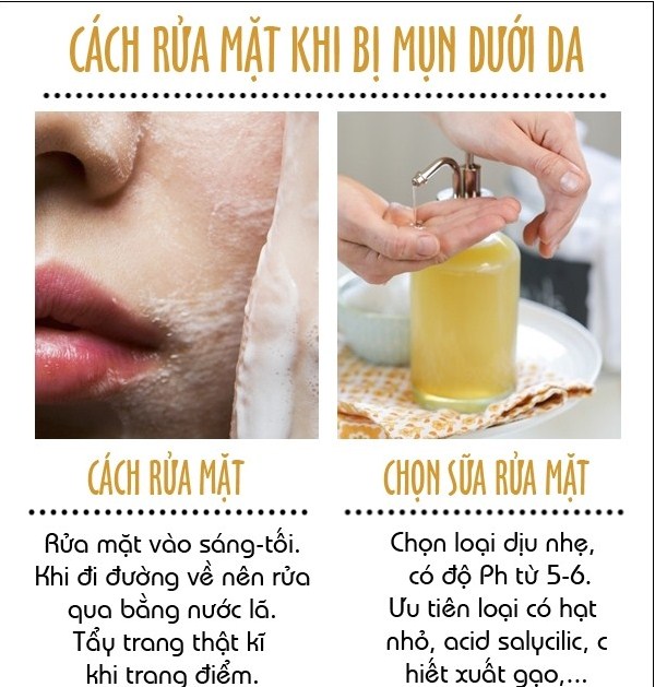 Photograph: Cách trị mụn ẩn dưới da hiệu quả tại nhà