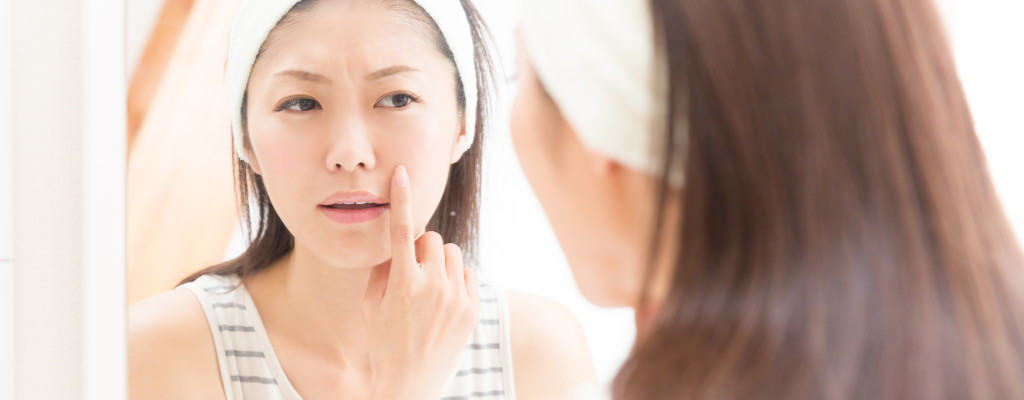 Trị mụn tuổi dậy thì – Cần hiểu rõ nguyên nhân và áp dụng đúng cách