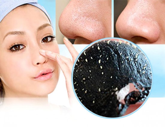 Cách phòng ngừa và làm giảm, làm hết mụn đầu đen